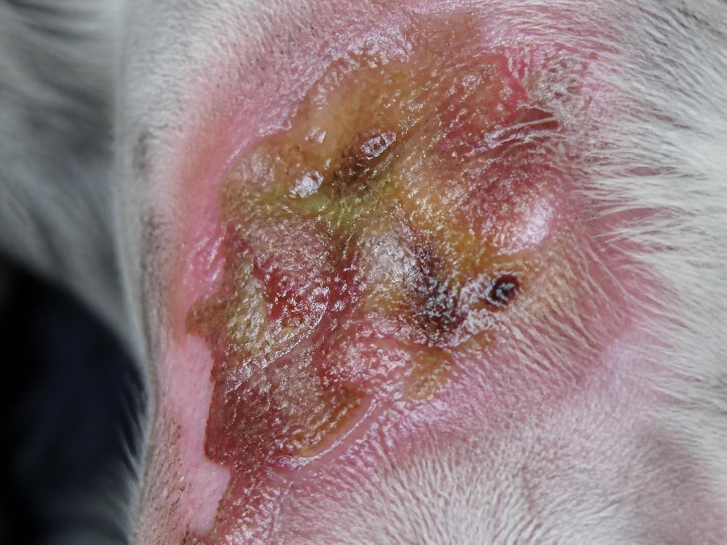 découvrez le rôle essentiel de la fibrine inflammatoire dans le développement et la progression des maladies chroniques, et son impact sur la santé à long terme.